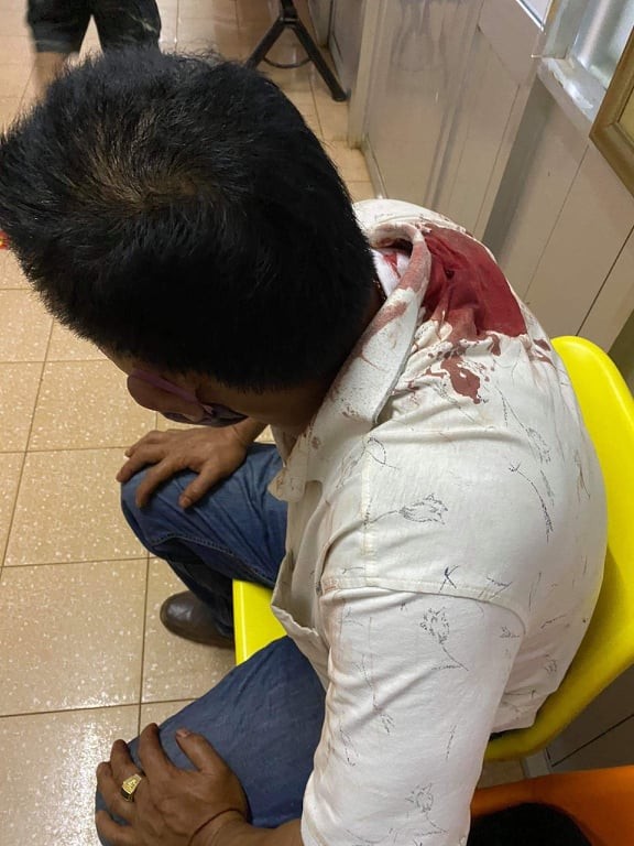 Hành khách bị tài xế đâm trọng thương vì mang lồng chim đi xe taxi ảnh 1