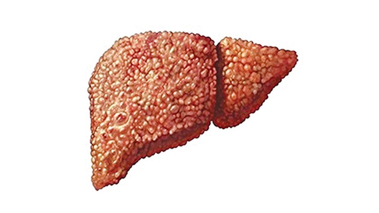 Một số thuốc có thể hại gan ảnh 1