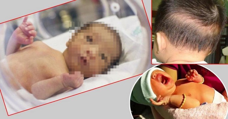 Những điều cần biết về bệnh còi xương ở trẻ em ảnh 1