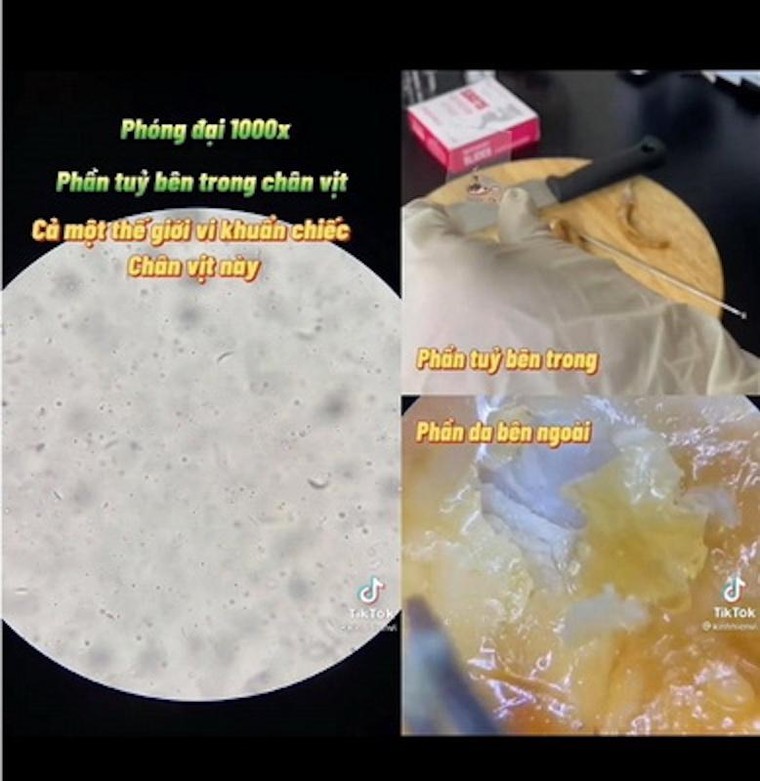 Mối nguy hại từ món ăn chân vịt cay Tứ Xuyên ảnh 1