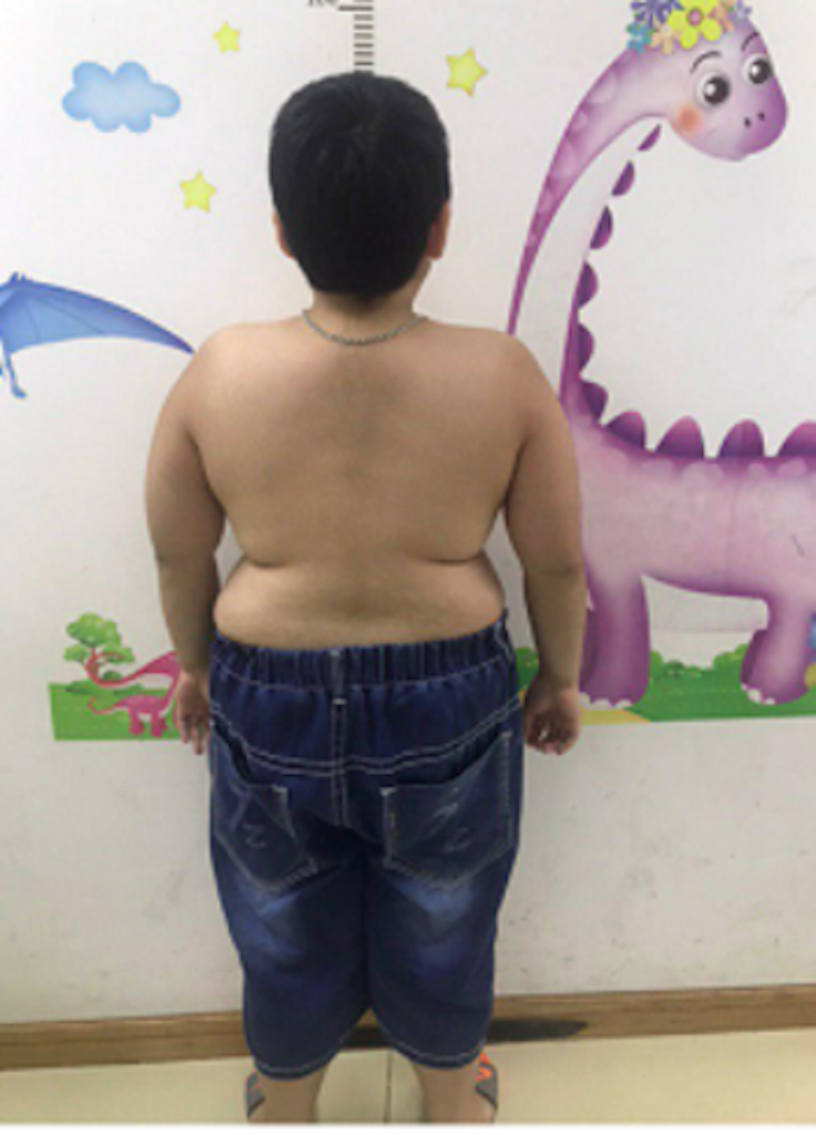 Cảnh báo nguy hiểm khi lạm dụng thuốc chống viêm ở trẻ nhỏ ảnh 1