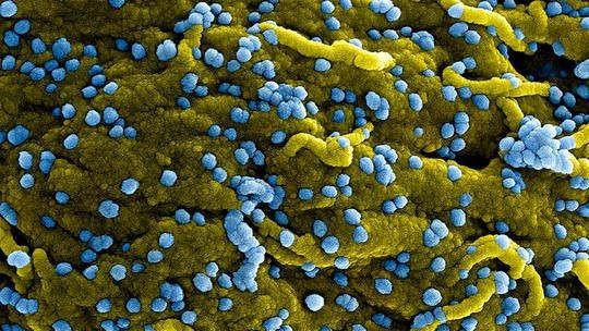Lo ngại virus mới gây tỷ lệ tử vong đến gần 90% ảnh 2