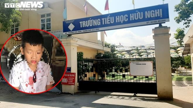 Khởi tố kẻ đánh dã man học sinh lớp 1 để giải quyết mâu thuẫn cho con ảnh 1