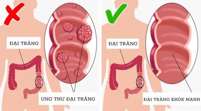 Ăn mỗi ngày 1 quả dưa chuột nhận ngay 13 lợi ích sức khỏe quý như vàng ảnh 2