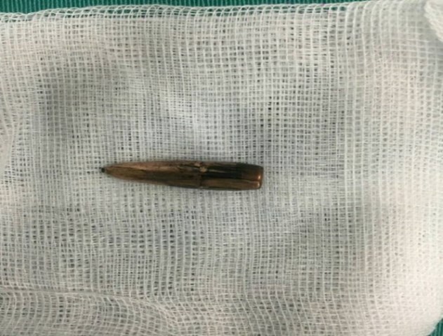 Dừng hoạt động các trường bắn để điều tra vụ 'đạn rơi' ở Vĩnh Phúc ảnh 2