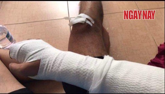 Đi xe GoViet bị tai nạn, GoViet chối bỏ trách nhiệm ảnh 1