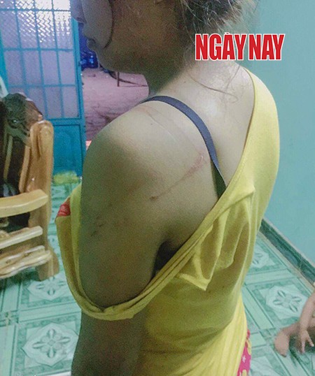 Bị truy tố dù tự vệ chính đáng gây thương tật… 1% ảnh 2