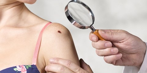 Sự thật nguy hiểm đằng sau những chấm lạ trên mặt ảnh 1