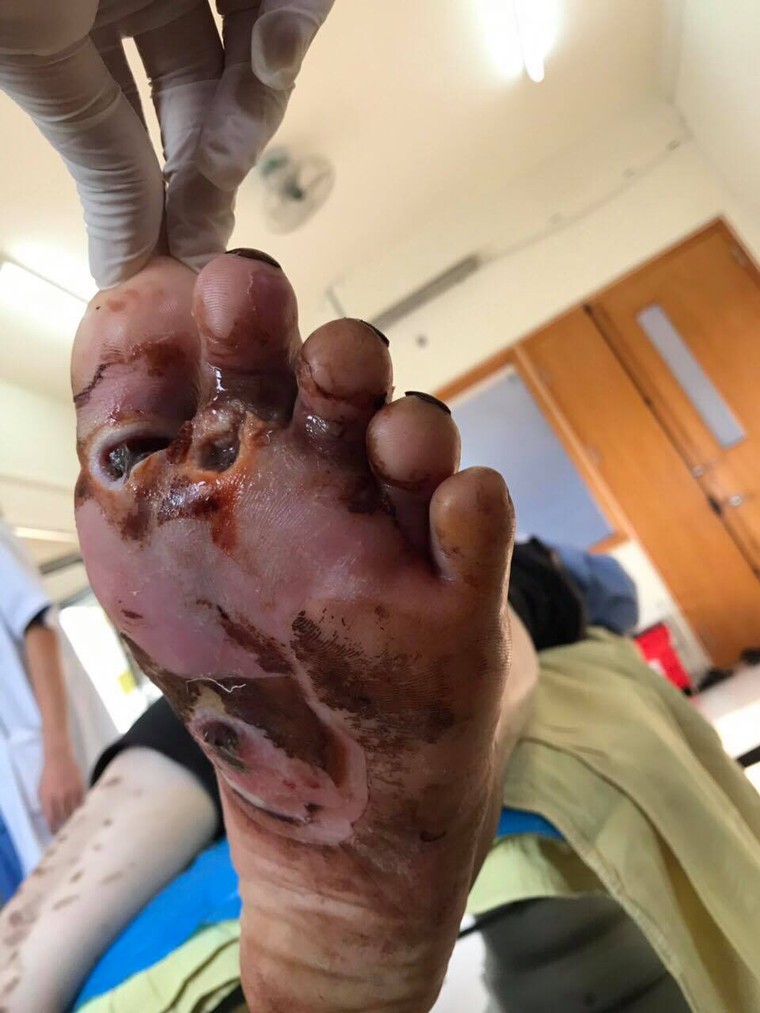 Nguy kịch vì tự chữa tiểu đường sai cách ảnh 1