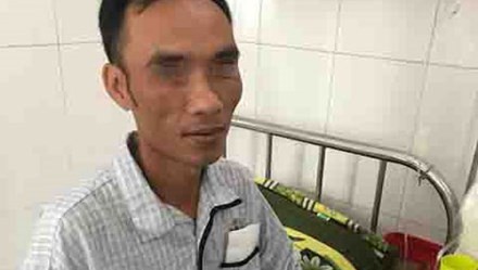 9 vụ tai nạn lao động nghiêm trọng đầu năm 2017 ảnh 5