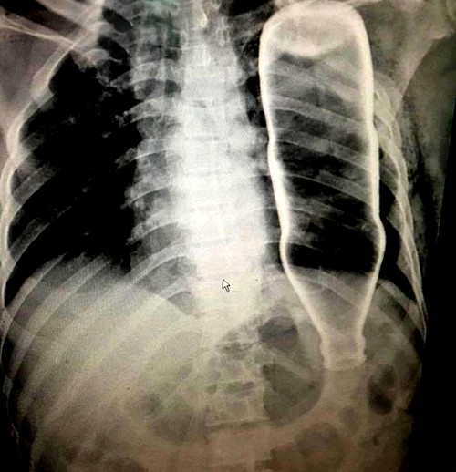 Những ca bệnh hy hữu ở Việt Nam năm 2017 ảnh 1