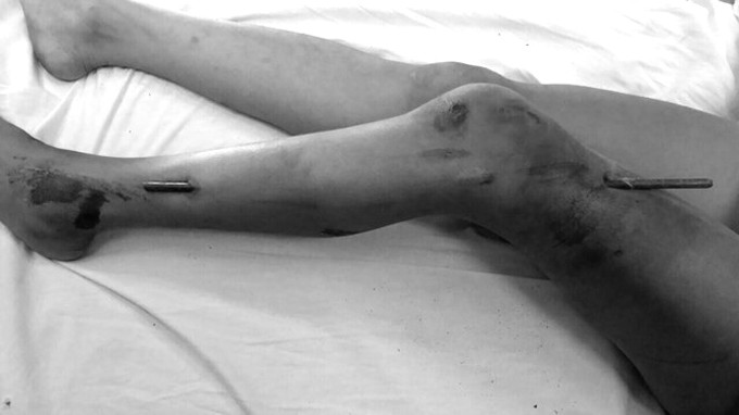 Những ca bệnh hy hữu ở Việt Nam năm 2017 ảnh 2