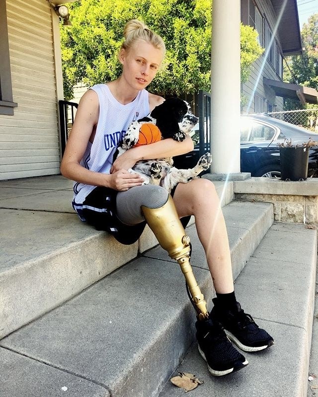 Hoại tử chân do... dùng băng vệ sinh ảnh 2