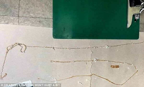 Nghiện ăn sushi, người đàn ông 'nuôi' con sán dài 1,5m trong bụng ảnh 1