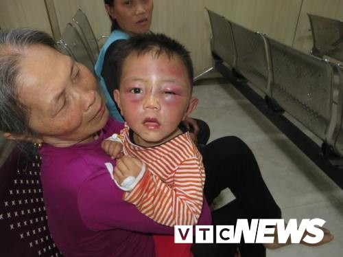 Bé trai 2 tuổi bị cha dượng đánh đập dã man ở Nghệ An ảnh 1