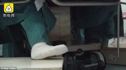 Bị gãy ngón chân, nữ bác sĩ vẫn đứng phẫu thuật suốt 5 tiếng ảnh 1