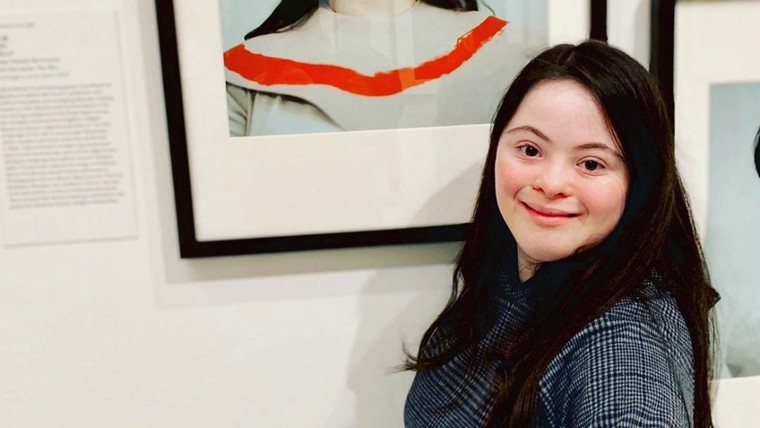 Cô gái bệnh Down làm mẫu cho Gucci ảnh 3