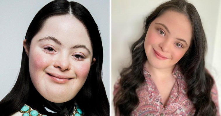 Cô gái bệnh Down làm mẫu cho Gucci ảnh 1