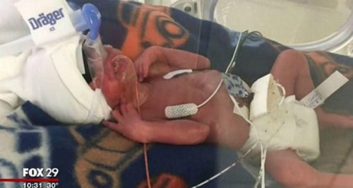 Người mẹ ung thư hy sinh thân mình cứu con trong bụng ảnh 1