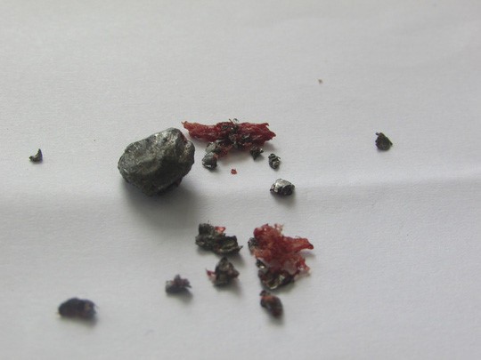 Thanh niên bị bắn nhiều phát đạn khi đi ăn tiệc ảnh 1