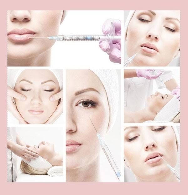 Filler - Tuyệt chiêu đẹp sau 5 phút ảnh 1