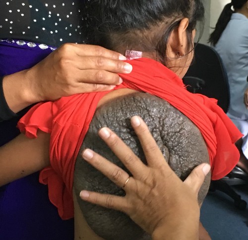 Những căn bệnh lạ lần đầu xuất hiện ở Việt Nam ảnh 2