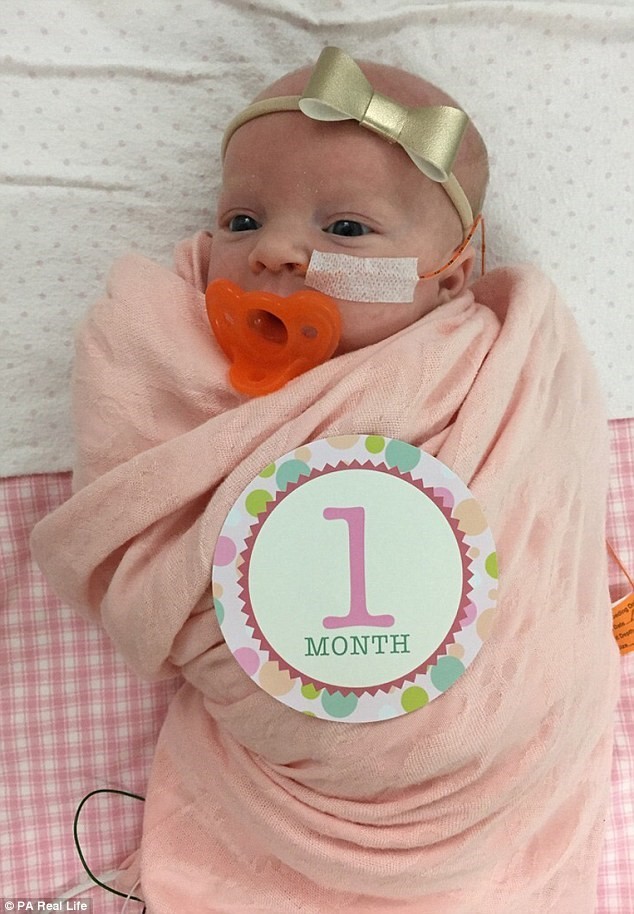 Em bé sinh ra với dạ dày, ruột, buồng trứng nằm ngoài bụng ảnh 1