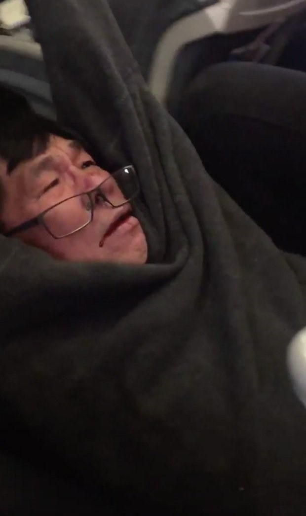 Bác sĩ gốc Việt có thể thành triệu phú nếu thắng kiện United Airlines ảnh 1