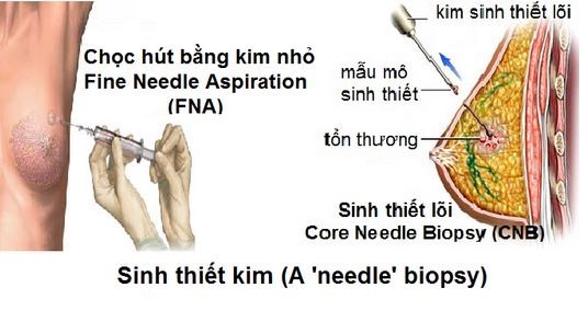6 xét nghiệm giúp phát hiện sớm ung thư ảnh 1