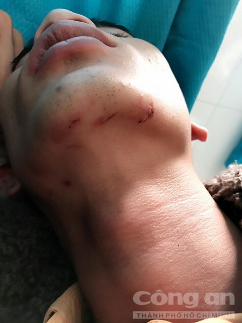 Côn đồ vác mã tấu đánh người giữa chợ đêm ảnh 1