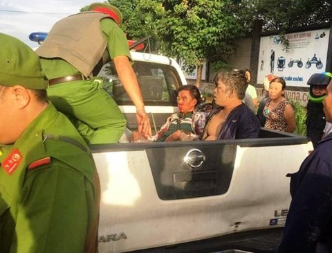 Nghi phạm trộm chó bị dân làng đánh dương tính với HIV ảnh 2