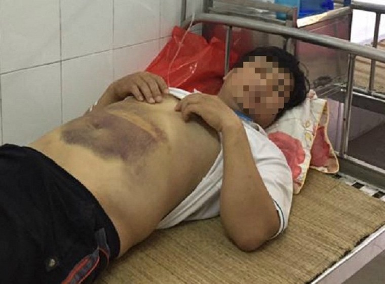 Hà Nội: Nhập viện cấp cứu sau khi công an mời lên làm việc ảnh 1