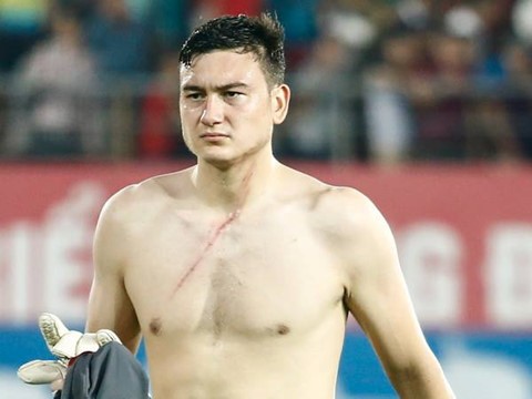 Sỹ Mạnh và Văn Lâm chính thức lên tiếng sau vụ việc “hành hung“ ảnh 1