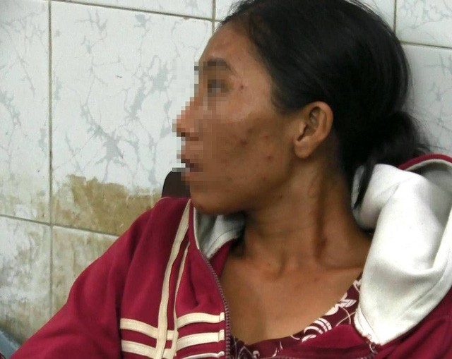 Người mẹ bế con ăn xin để mua ma túy khai gì? ảnh 1