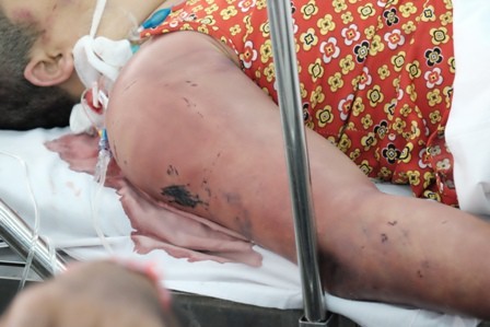 Mời thầy về trừ tà, 2 chị em bị đánh 'thập tử nhất sinh' ảnh 1