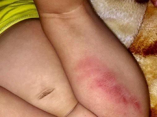 Huế: Đình chỉ điểm giữ trẻ nghi bạo hành bé gái 16 tháng tuổi ảnh 2