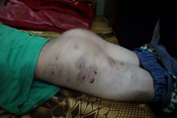 Người cha dùng dây điện đánh bé trai 9 tuổi: 'Là cha mẹ ai nỡ lòng đánh con mình' ảnh 2