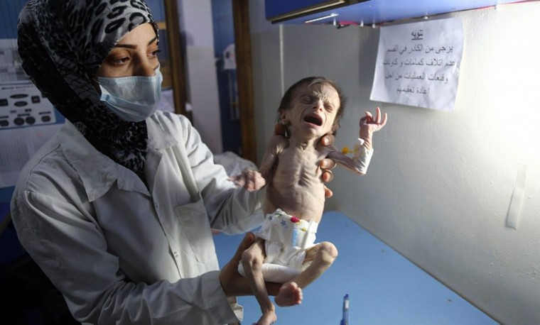 Nạn đói kinh hoàng ngay tại ngưỡng cửa thủ đô Syria ảnh 1