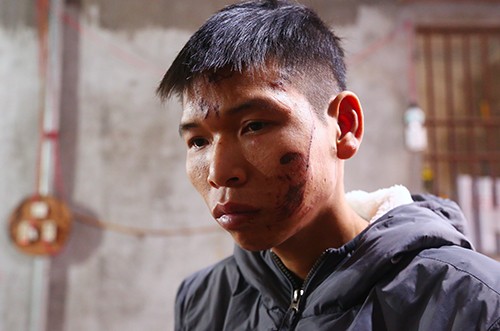 Người dân Quan Độ chưa hết bàng hoàng sau vụ nổ thảm khốc ảnh 1