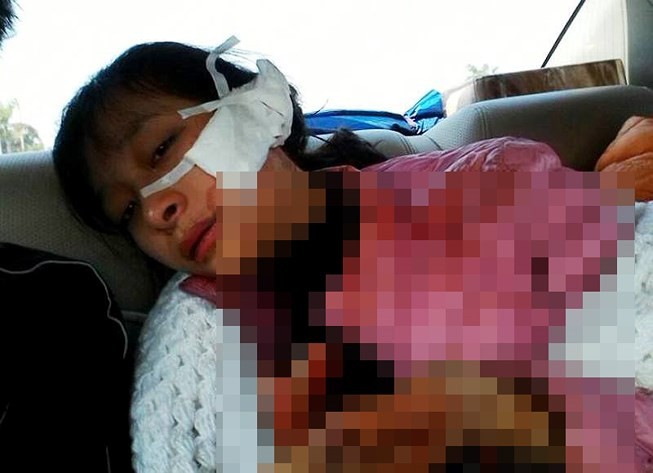 Thanh Hóa: Khởi tố hung thủ rạch mặt nữ sinh lớp 11 ảnh 1