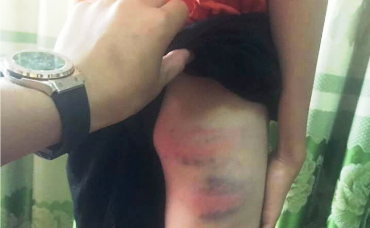 Vụ cô giáo bạo hành con chồng: Do bé trai có biểu hiện hỗn láo ảnh 1