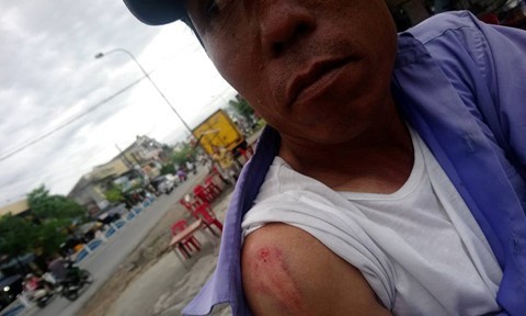 Huế: Grab và xe ôm truyền thống hỗn chiến, 1 người bị thương ảnh 1