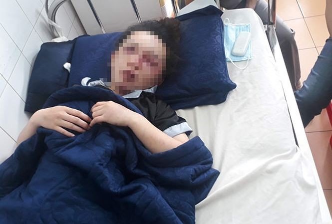 Tạm giữ 4 đối tượng hành hung dã man nữ nhân viên spa ảnh 1