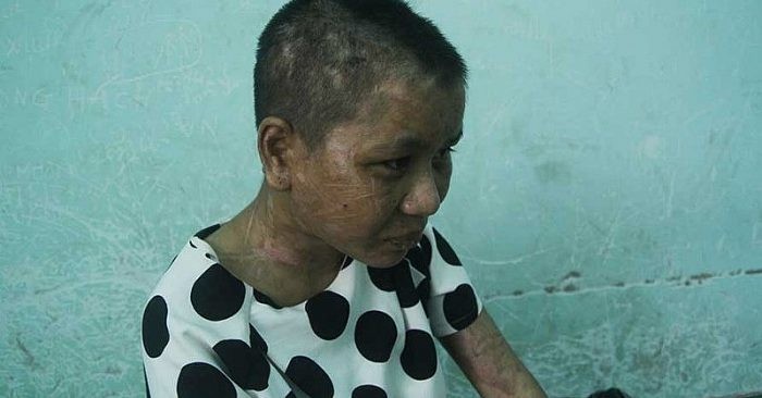 Vụ tra tấn người giúp việc: Tuyên án bà chủ 10 năm tù giam ảnh 1