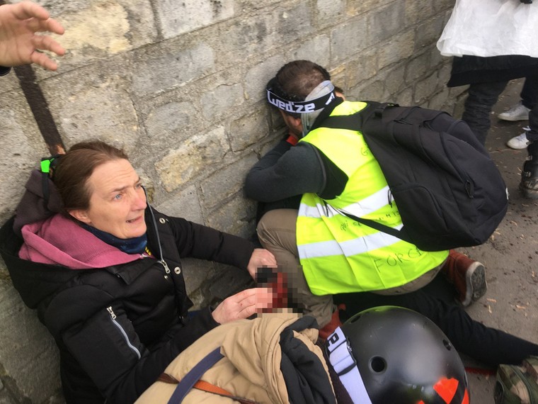 Pháp: Người biểu tình phe Áo vàng mất tay do lựu đạn của cảnh sát ảnh 1