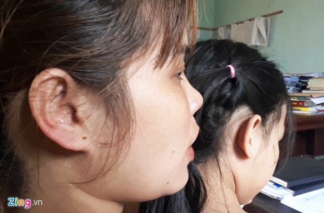 Người bố nghiện ma túy đánh con gái thâm tím người do học kém anh trai ảnh 2