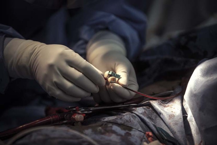 Doctors install equipment to perform a VAV-ECMO diversion, a procedure for severe heart and lung failure, in the Wuhan Pulmonary Hospital ICU, Hubei province, March 21, 2020. Sun Zhan for Sixth Tone