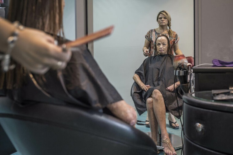 Ảnh người đẹp bị bỏng 85% được chọn tranh giải thưởng Portrait of Humanity 2020 ảnh 5