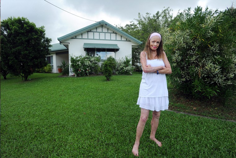 Ảnh người đẹp bị bỏng 85% được chọn tranh giải thưởng Portrait of Humanity 2020 ảnh 2