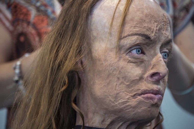 Ảnh người đẹp bị bỏng 85% được chọn tranh giải thưởng Portrait of Humanity 2020 ảnh 4